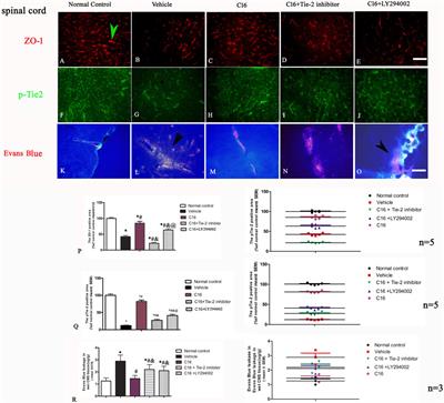 Neuroprotective effects of a novel peptide through the Rho-integrin-Tie2 and PI3K/Akt pathways in experimental autoimmune encephalomyelitis model